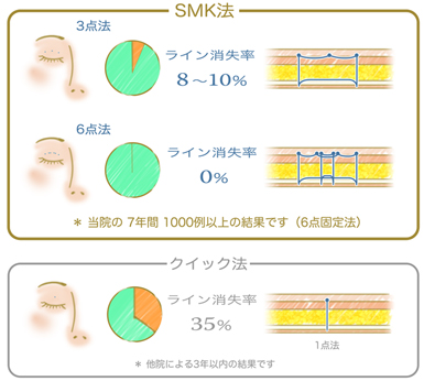 埋没法はライン消失率0％