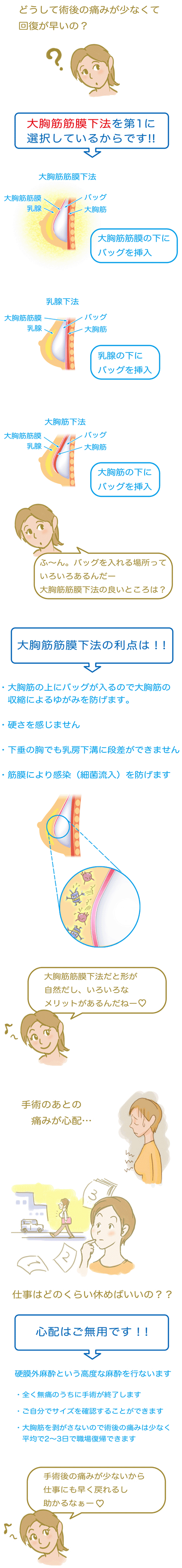 大胸筋筋膜下法