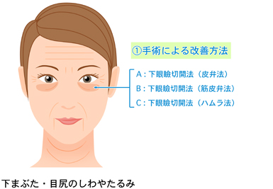 (1) 手術による改善方法